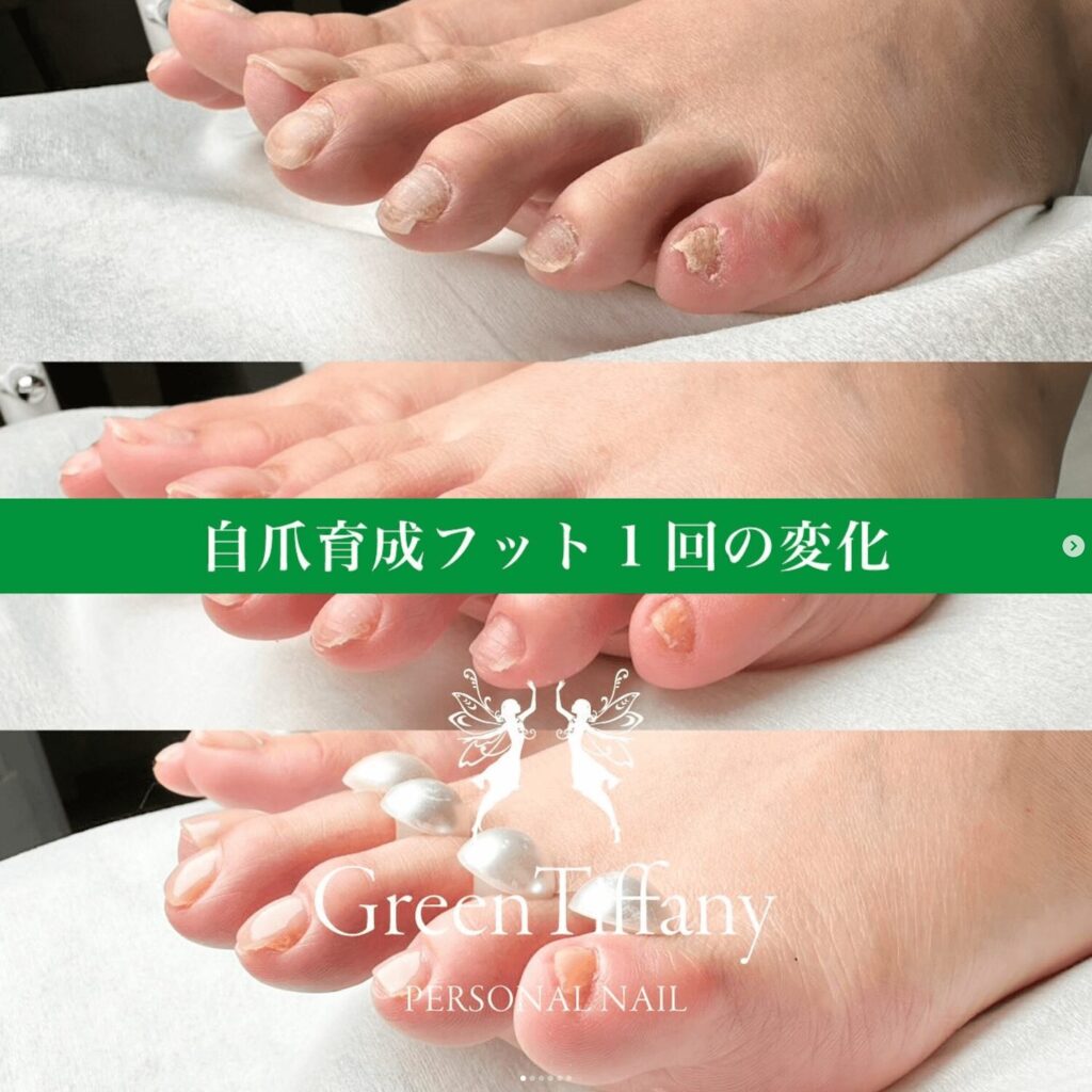 footcarejizume2